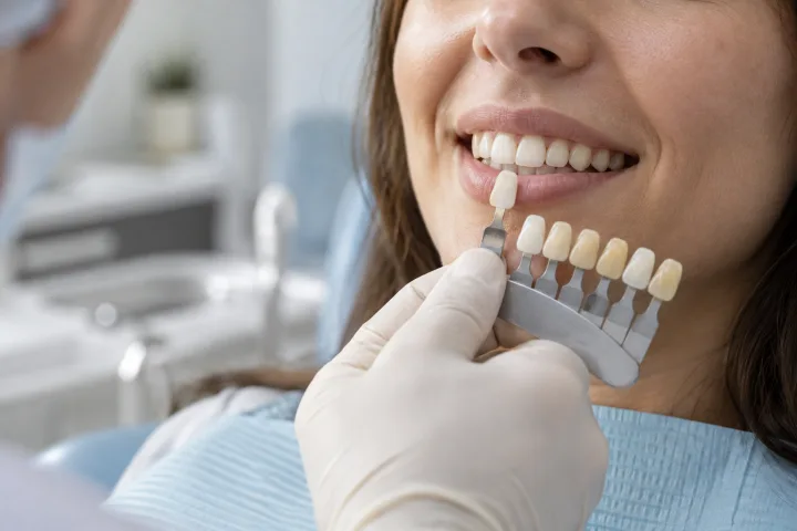 Imagem informativa sobre Branqueamento dentário
